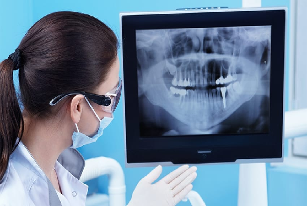 Dental X Ray