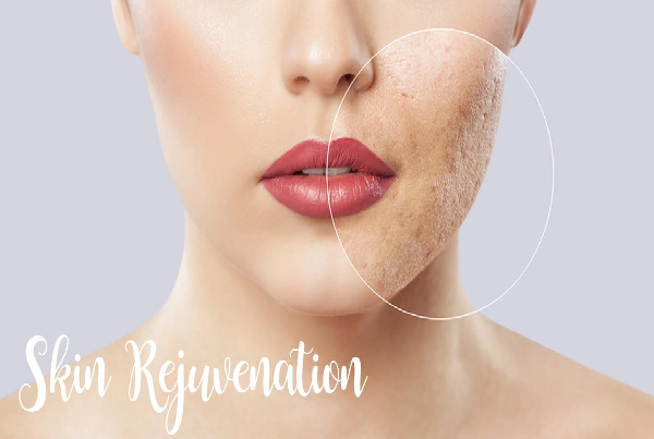 Skin Rejuvenation