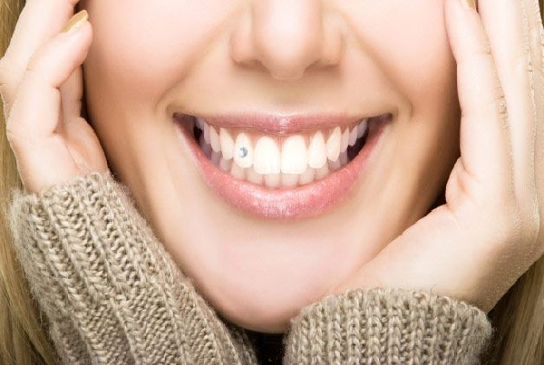 Best Dental Clinic for Braces
